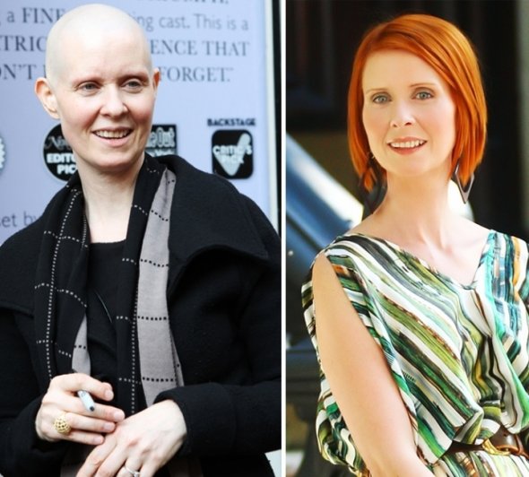 Восстановление волос после химиотерапии, как отрастить волосы после химиотерапии